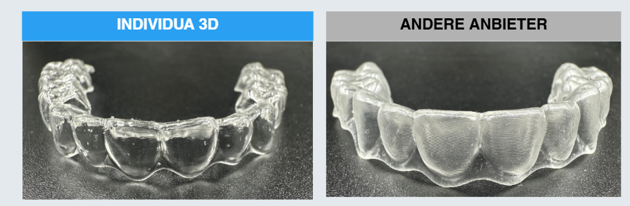 Detailed render of aligner perfectly fitting teeth model